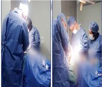 أطباء "شبراخيت المركزي" ينقذون طفلًا من مضاعفات خطيرة
