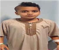 مستشفى الطوارئ الجامعي بسوهاج تنقذ طفل من نزيف حاد بالمخ